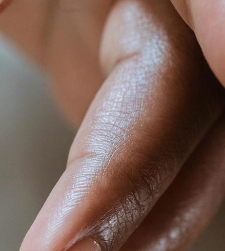 Nail Health Overview