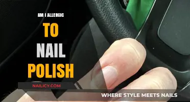 Could Your Nail Polish Be Causing an Allergic Reaction?