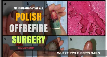 Should You Remove Nail Polish Before Surgery? Essential Pre-Op Tips