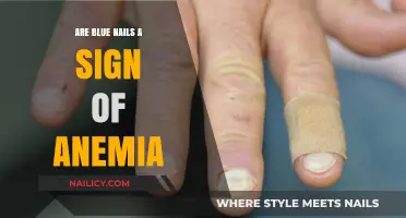 Blue Nails and Anemia: Uncovering the Hidden Health Connection