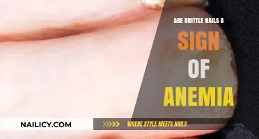 Brittle Nails and Anemia: Uncovering the Hidden Health Connection