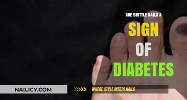 Brittle Nails and Diabetes: Uncovering the Surprising Connection and Risks