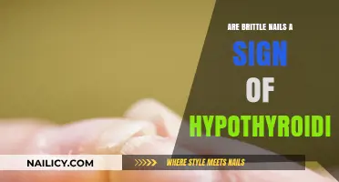 Brittle Nails and Hypothyroidism: Uncovering the Hidden Connection