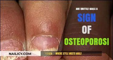 Brittle Nails and Osteoporosis: Uncovering the Hidden Connection
