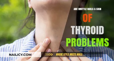 Brittle Nails and Thyroid Health: Uncovering the Hidden Connection