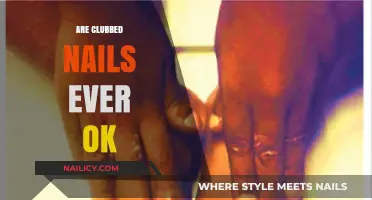 Clubbed Nails: When Are They Normal and When to Worry?