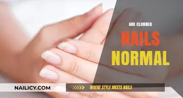 Are Clubbed Nails Normal? Understanding Causes, Concerns, and When to Seek Help