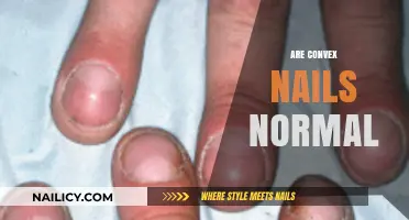 Are Convex Nails Normal? Understanding Nail Shape and Health Concerns