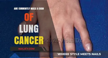 Are Clubbed Nails a Warning Sign of Lung Cancer?