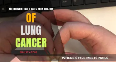 Curved Nails and Cancer: Uncovering the Connection