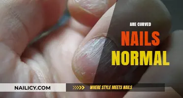Curved Nails: Understanding Their Normalcy, Causes, and Health Implications