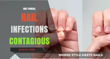 Are Fungal Nail Infections Contagious? Understanding Transmission and Prevention