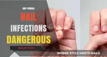 Are Fungal Nail Infections Dangerous? Risks, Complications, and Treatment Options