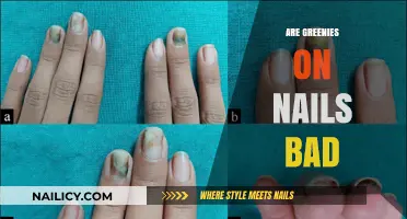 Are Greenies on Nails Harmful? Uncovering the Truth About Nail Health