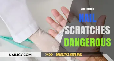 Are Human Nail Scratches Dangerous? Uncovering the Risks and Realities