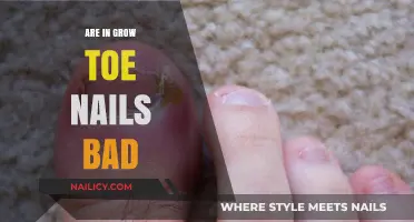 Toenail Growth: When Good Nails Go Bad