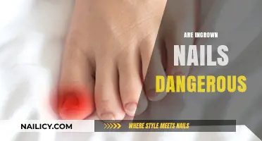 Are Ingrown Nails Dangerous? Understanding Risks and Prevention Tips