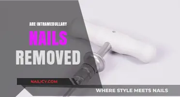 Intramedullary Nails: To Remove or Not?