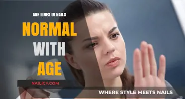 Aging Nails: Are Lines and Ridges a Normal Part of Growing Older?