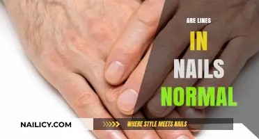 Are Nail Lines Normal? Understanding Causes and When to Worry