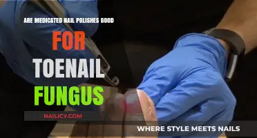 Medicated Nail Polishes: Effective Toenail Fungus Treatment or Just a Trend?