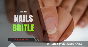 Why Are My Nails Brittle? Causes, Solutions, and Prevention Tips