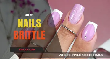 Brittle Nails: Causes, Solutions, and Tips for Stronger, Healthier Nails