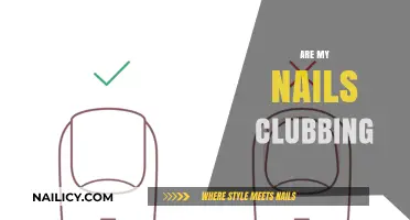 Are My Nails Clubbing? Understanding Symptoms, Causes, and When to Worry