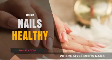 Are My Nails Healthy? Signs, Care Tips, and Common Concerns