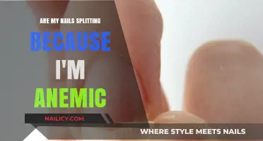 Are Splitting Nails a Sign of Anemia? Uncovering the Link
