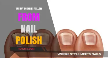 Why Are My Toenails Yellow? Nail Polish Effects Explained