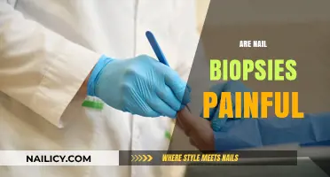 Do Nail Biopsies Hurt? Pain Expectations and Recovery Tips