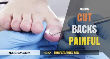 Nail Cut Backs: Painful or Not?