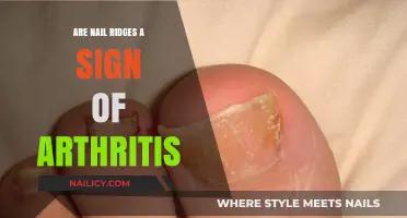 Nail Ridges and Arthritis: Uncovering the Hidden Connection