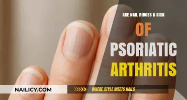 Nail Ridges and Psoriatic Arthritis: Uncovering the Hidden Connection