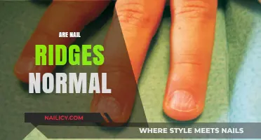 Are Nail Ridges Normal? Understanding Causes and When to Worry