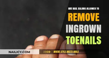 Toenail Troubles: Can Nail Salons Remove Ingrown Nails?