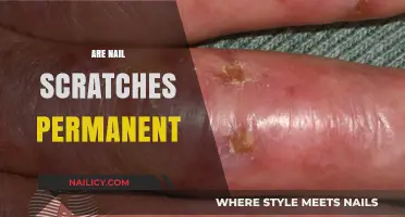Are Nail Scratches Permanent? Understanding Healing and Long-Term Effects