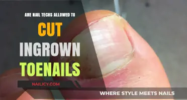 Toenail Troubles: Can Nail Techs Cut Ingrown Nails?