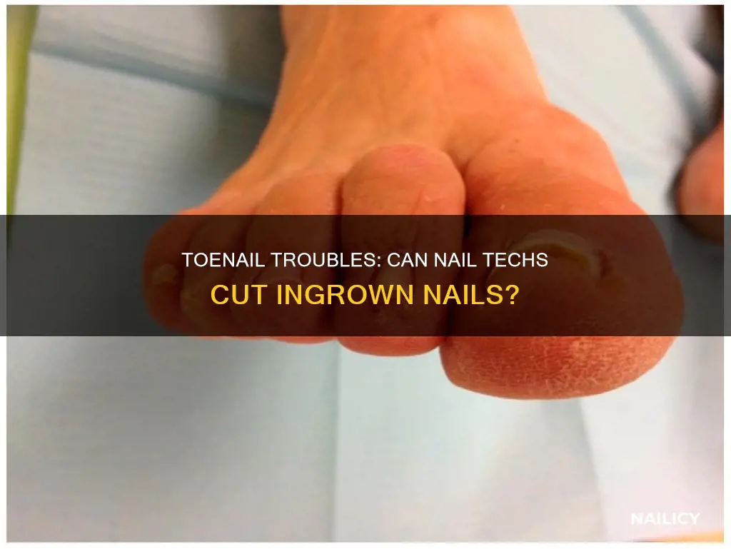are nail techs allowed to cut ingrown toenails