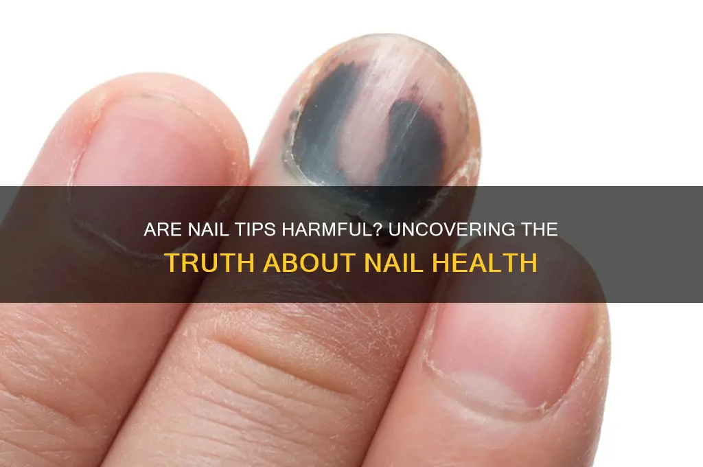 are nail tips bad for your nails
