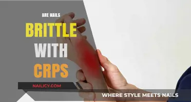 Brittle Nails and CRPS: Understanding the Surprising Connection