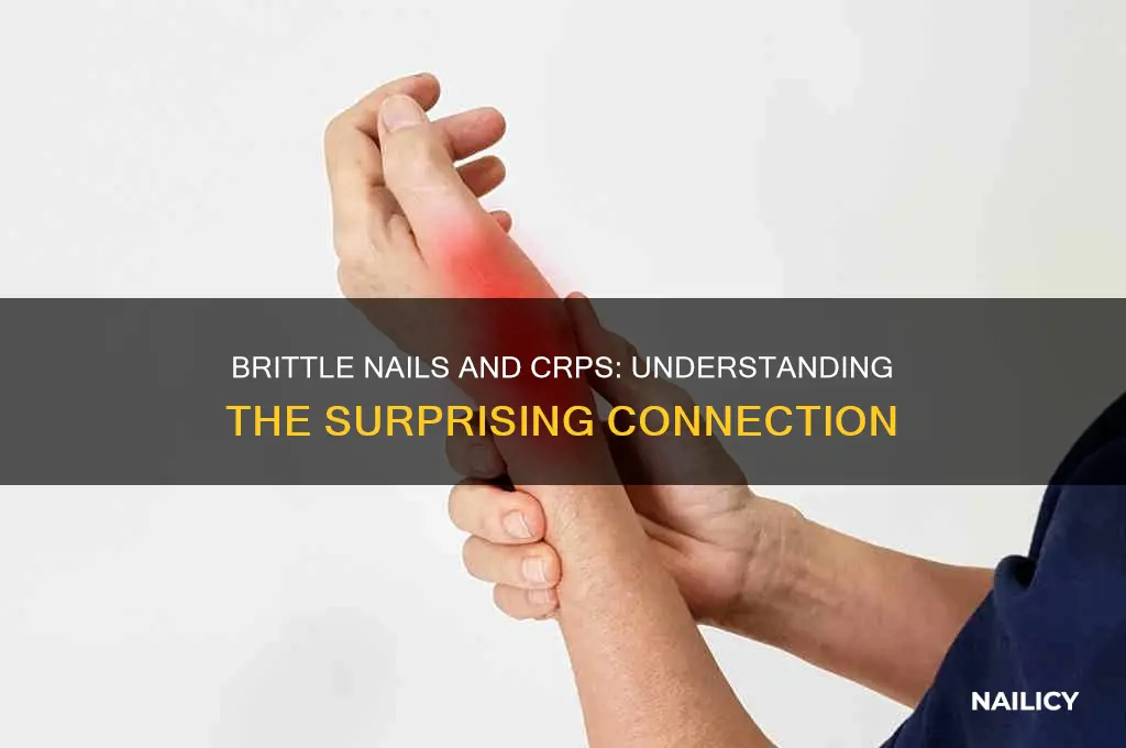 are nails brittle with crps