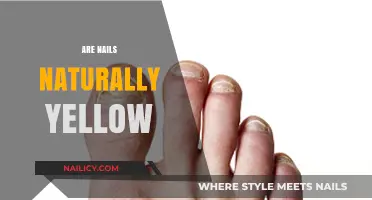 Why Are Nails Naturally Yellow? Causes and Solutions Explained