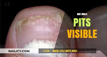 Are Nail Pits Visible? Understanding Nail Texture and Appearance