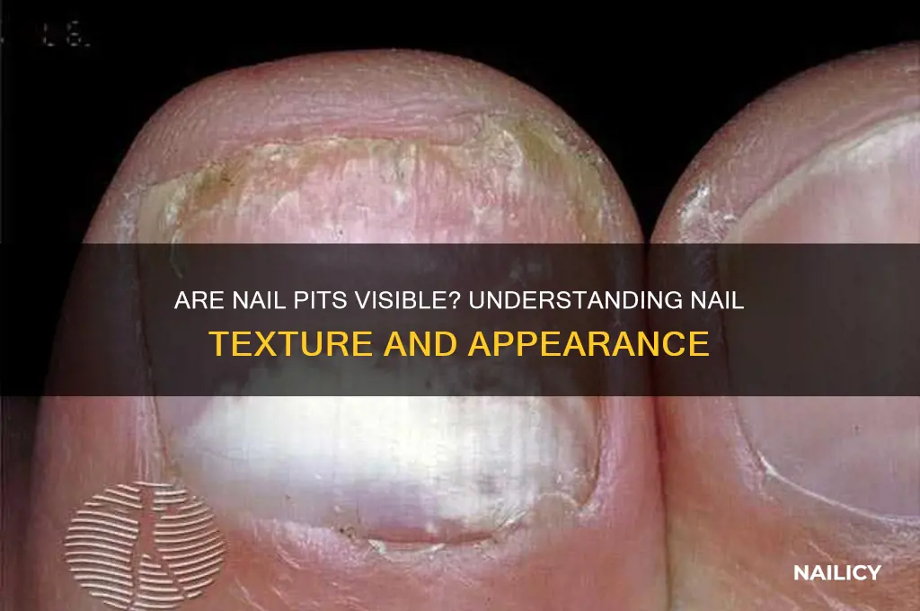 are nails pits visible