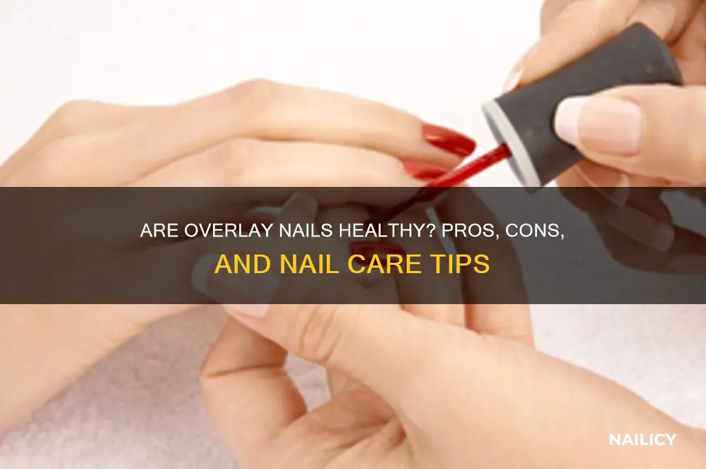 are overlay nails healthy