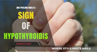 Peeling Nails and Hypothyroidism: Uncovering the Hidden Connection