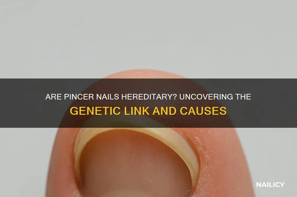 are pincer nails hereditary