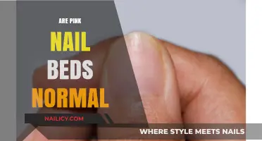 Are Pink Nail Beds Normal? Understanding Nail Health and Color Variations